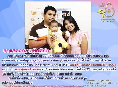 คุณชนัญชิดา จันทร์หุนีย์อายุ 32 ปี ได้คลอดน้องปานะ เป็นที่เรียบร้อยแล้ว