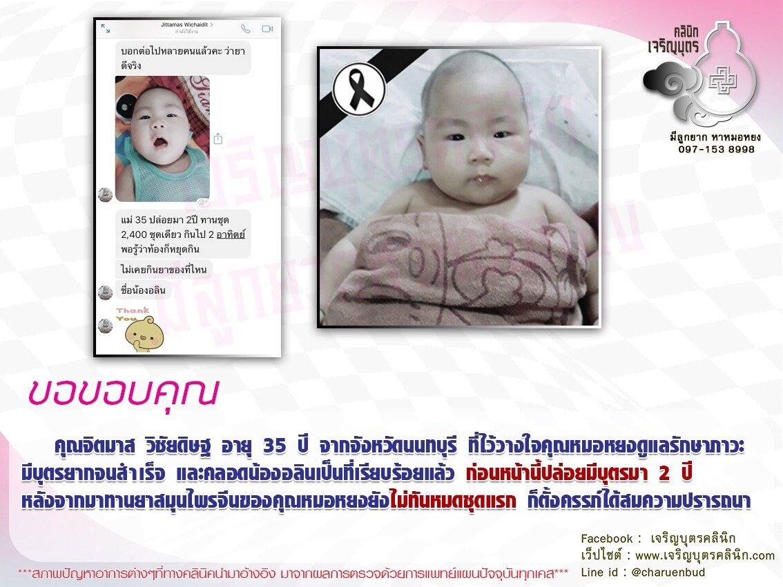 คุณจิตมาส วิชัยดิษฐ อายุ 35 ปี จากจังหวัดนนทบุรี ที่ไว้วางใจคุณหมอหยงดูแลรักษาภาวะมีบุตรยากจนสำเร็จ และคลอดน้องอลินเป็นที่เรียบร้อยแล้ว