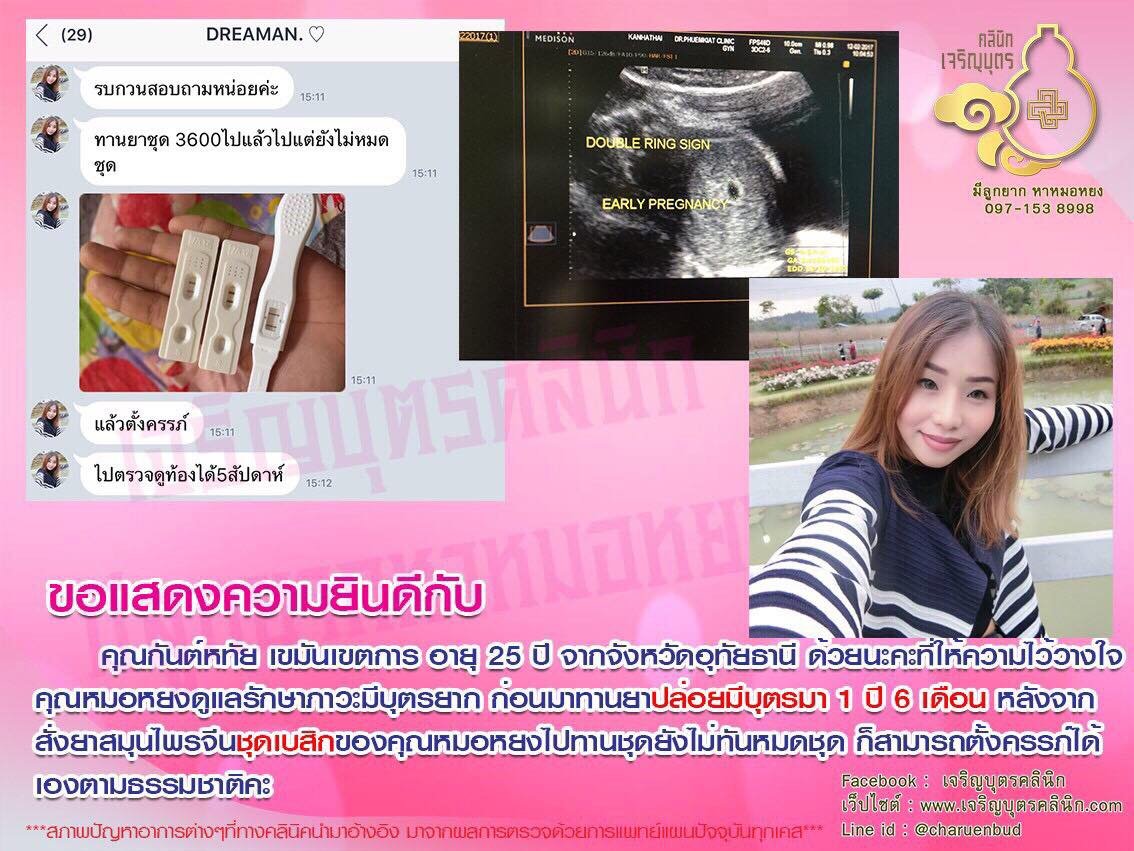คุณกันต์หทัย เขมันเขตการ อายุ 25 ปี จากจังหวัดอุทัยธานี ให้ความไว้วางใจคุณหมอหยง ดูแลรักษาภาวะมีบุตรยาก