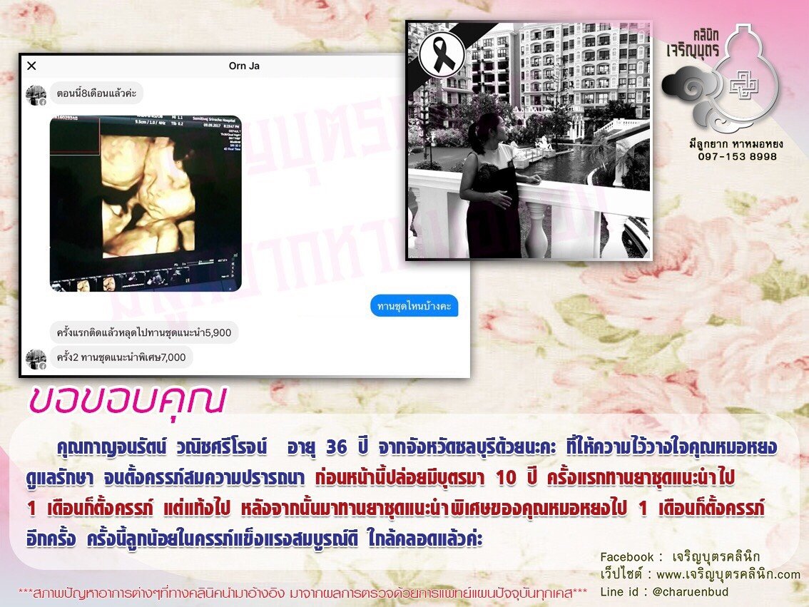 คุณกาญจนรัตน์ วณิชศรีโรจน์ อายุ 36 ปี จากจังหวัดชลบุรี ให้ความไว้วางใจคุณหมอหยงดูแลรักษาจนตั้งครรภ์สมความปรารถนา