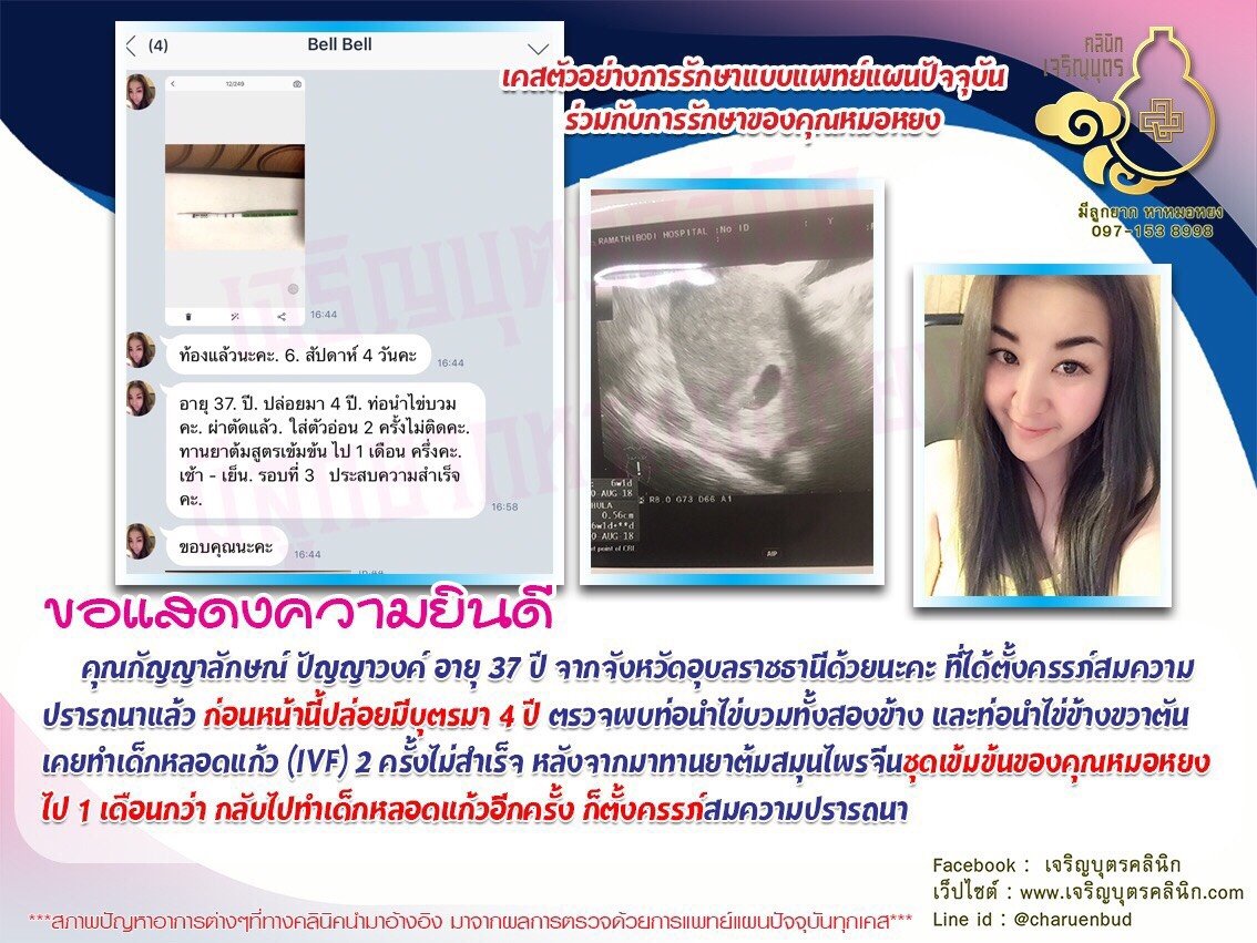 คุณกัญญาลักษณ์ ปัญญาวงค์ อายุ 37 ปี จากจังหวัดอุบลราชธานี ได้ตั้งครรภ์สมความปรารถนาแล้ว