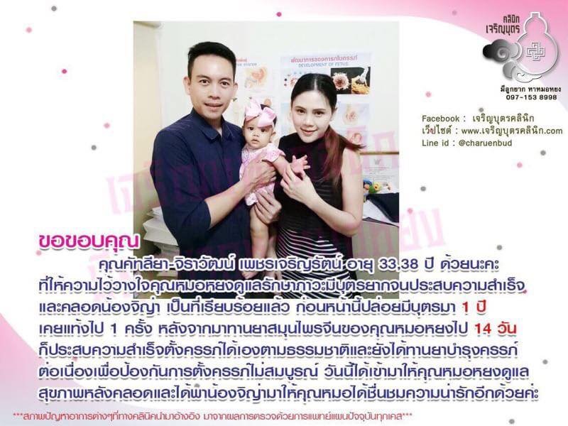 คุณคัทลียา-จิราวัฒน์ เพชรเจริญรัตน์ อายุ 33,38 ปี ให้ความไว้วางใจคุณหมอหยงดูแลรักษาภาวะมีบุตรยาก จนประสบความสำเร็จและคลอดน้องจิญ่า เป็นที่เรียบร้อยแล้ว