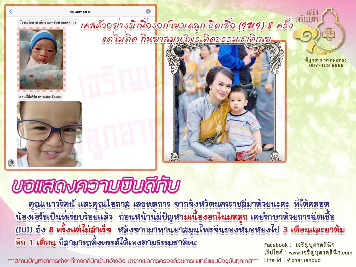 คุณเนาวรัตน์ และคุณโอภาส เลขพลการ จากจังหวัดนครราชสีมา ได้คลอดน้องเอริ์ธเป็นที่เรียบร้อยแล้ว