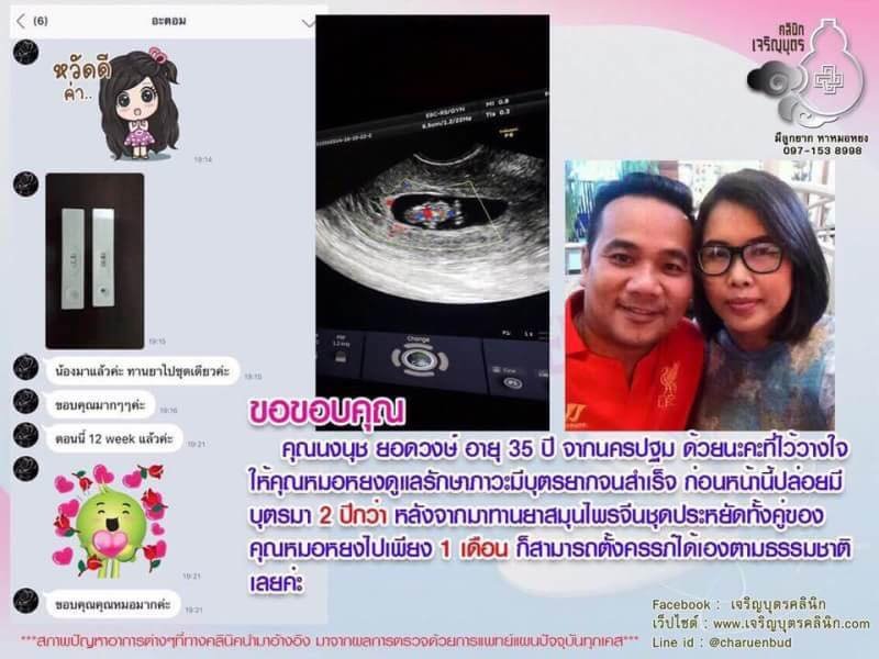 คุณนงนุช ยอดวงษ์ อายุ 35 ปี จากนครปฐม ไว้วางใจให้คุณหมอหยงดูแลรักษาภาวะมีบุตรยากจนสำเร็จ