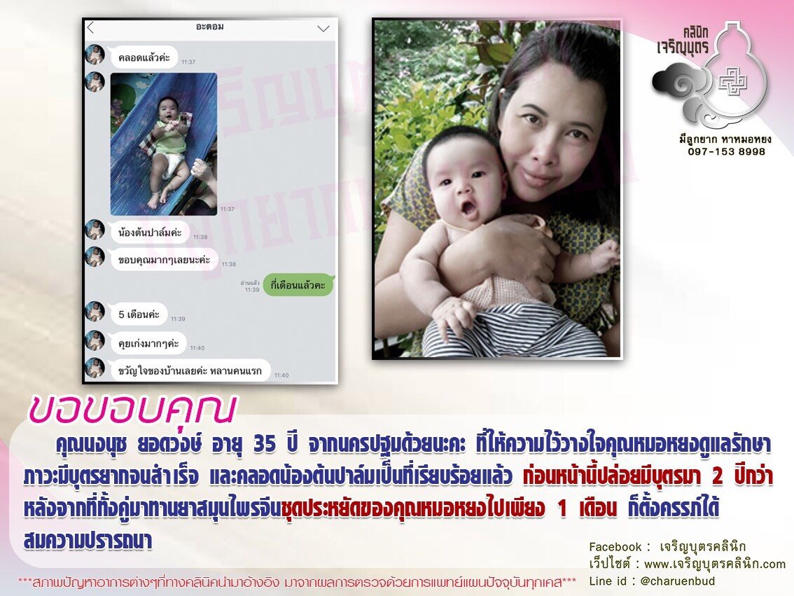 คุณนงนุช ยอดวงษ์ อายุ 35 ปี จากนครปฐม ที่ให้ความไว้วางใจคุณหมอหยงดูแลรักษาภาวะมีบุตรยากจนสำเร็จ และคลอดน้องต้นปาล์มเป็นที่เรียบร้อยแล้ว