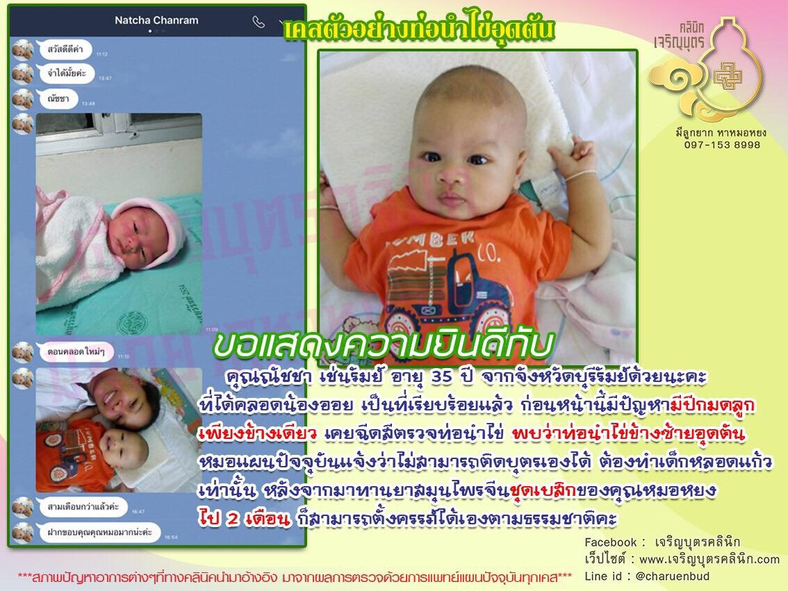 คุณณัชชา เช่นรัมย์ อายุ 35 ปี จากจังหวัดบุรีรัมย์ได้คลอดน้องออยเป็นที่เรียบร้อยแล้ว