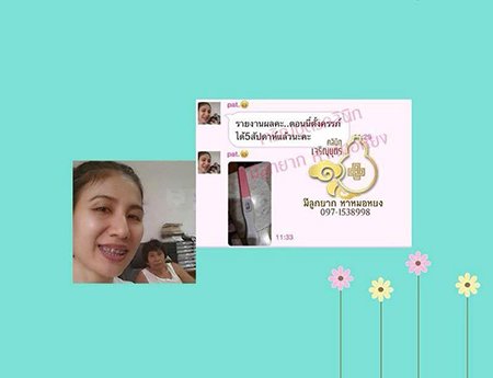 คุณพัชรีวรรณ ใจสม อายุ39ปี จากสุราษฎร์ธานี ตรวจพบการตั้งครรภ์แล้ว