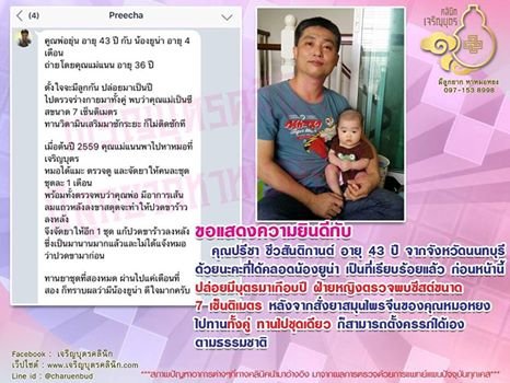 คุณปรีชา ชีวสันติกานต์ อายุ 43 ปี จากจังหวัดนนทบุรี ได้คลอดน้องยูน่าเป็นที่เรียบร้อยแล้ว