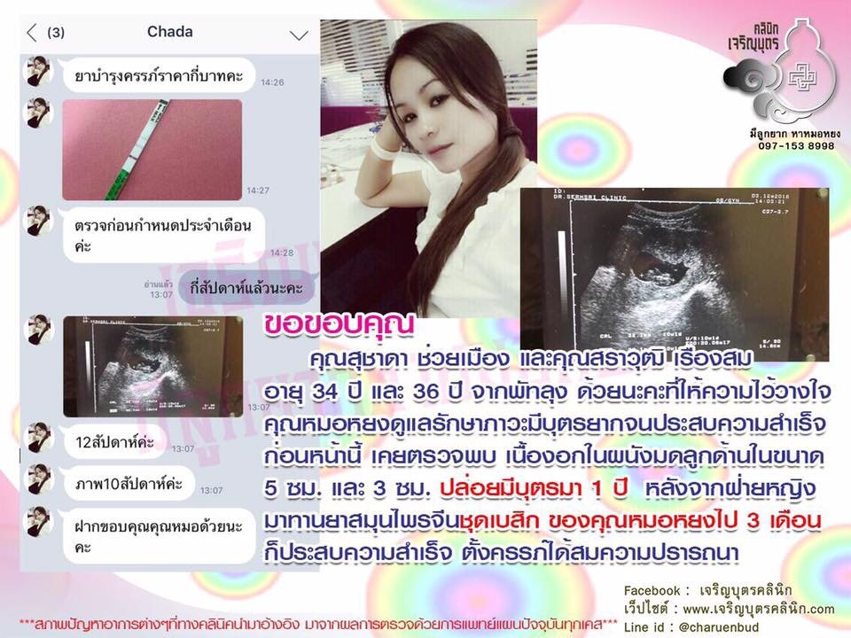 คุณสุชาดา ช่วยเมือง และคุณสราวุฒิ เรืองสม อายุ 34 ปี และ 36 ปี จากพัทลุง ให้ความไว้วางใจคุณหมอหยงดูแลรักษาภาวะมีบุตรยากจนประสบความสำเร็จ