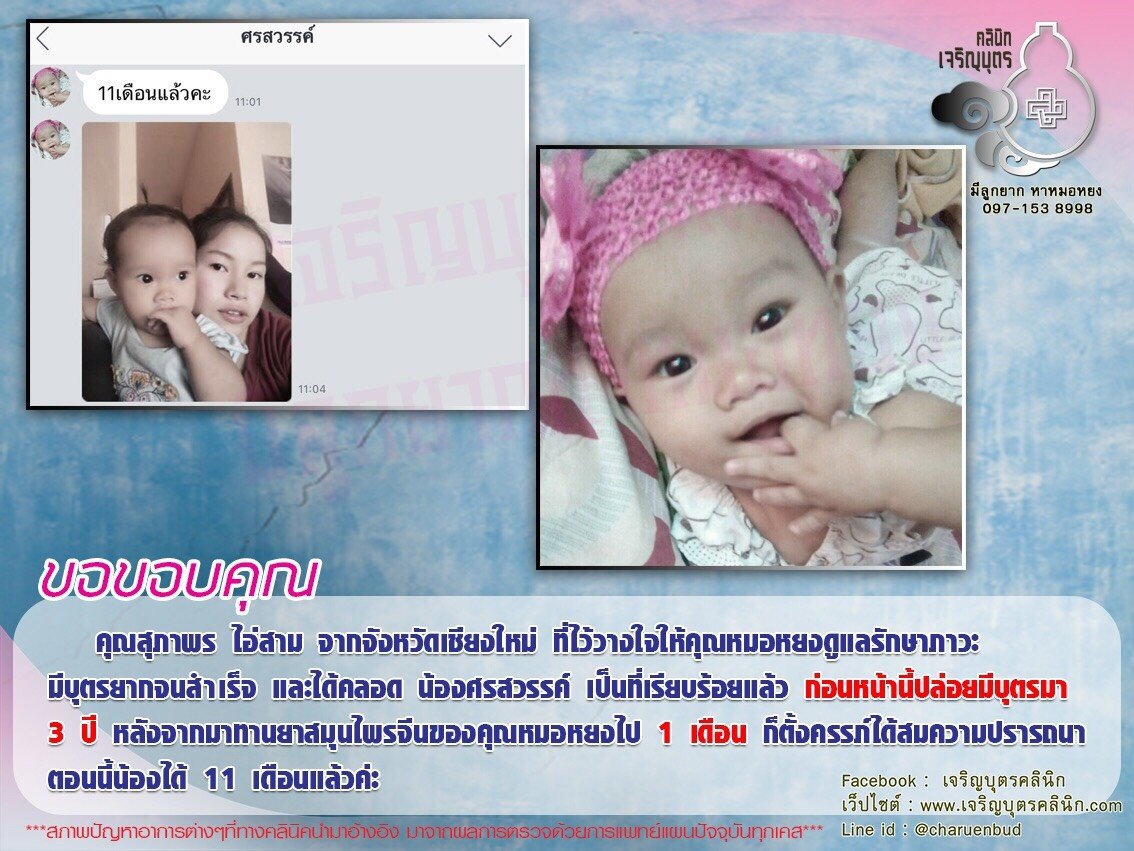 คุณสุภาพร ไอ่สาม จากจังหวัดเชียงใหม่ ที่ไว้วางใจให้คุณหมอหยงดูแลรักษาภาวะมีบุตรยากจนสำเร็จและได้คลอด น้องศรสวรรค์ เป็นที่เรียบร้อยแล้ว