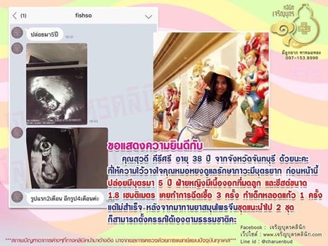 คุณสุวดี คีรีศรี อายุ 38 ปี จากจังหวัดจันทบุรี ให้ความไว้วางใจคุณหมอหยงดูแลรักษาภาวะมีบุตรยาก