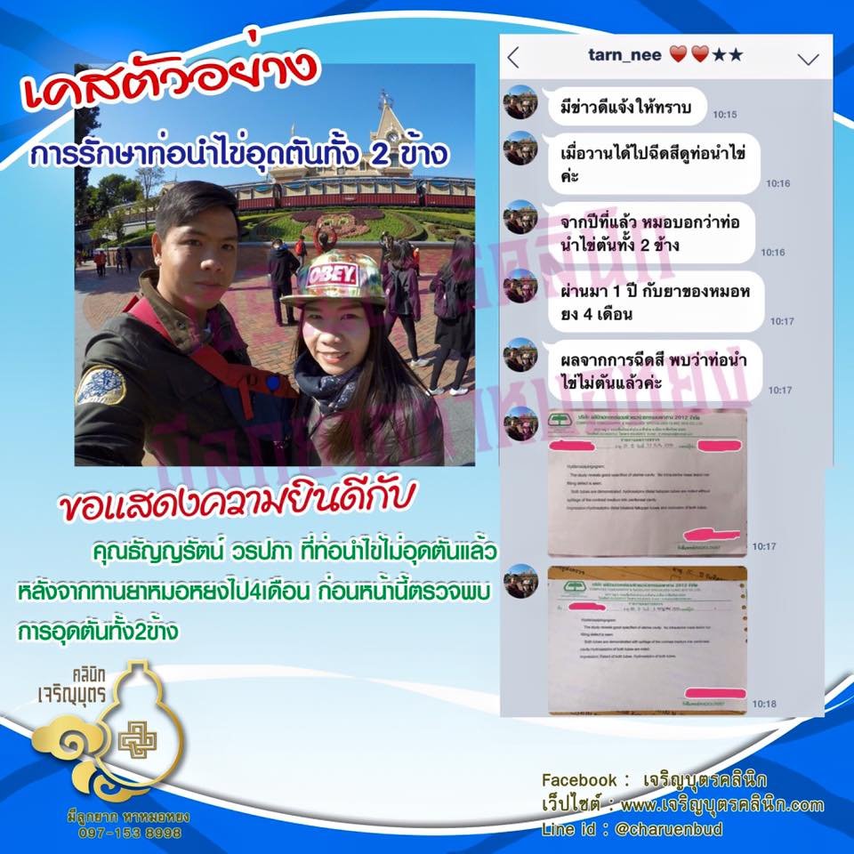 คุณธัญญรัตน์ วรปภา อายุ 30 ปี จากเชียงใหม่ ที่ฉีดสีไม่พบการอุดตันของท่อนำไข่ทั้ง 2 ข้างเเล้ว