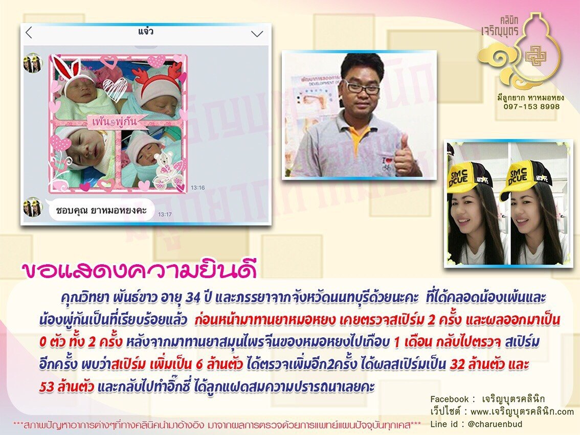 คุณวิทยา พันธ์ขาว อายุ 34 ปี และภรรยาจากจังหวัดนนท์บุรี ได้คลอดน้องเพ้นและน้องพู่กัน เป็นที่เรียบร้อยแล้ว