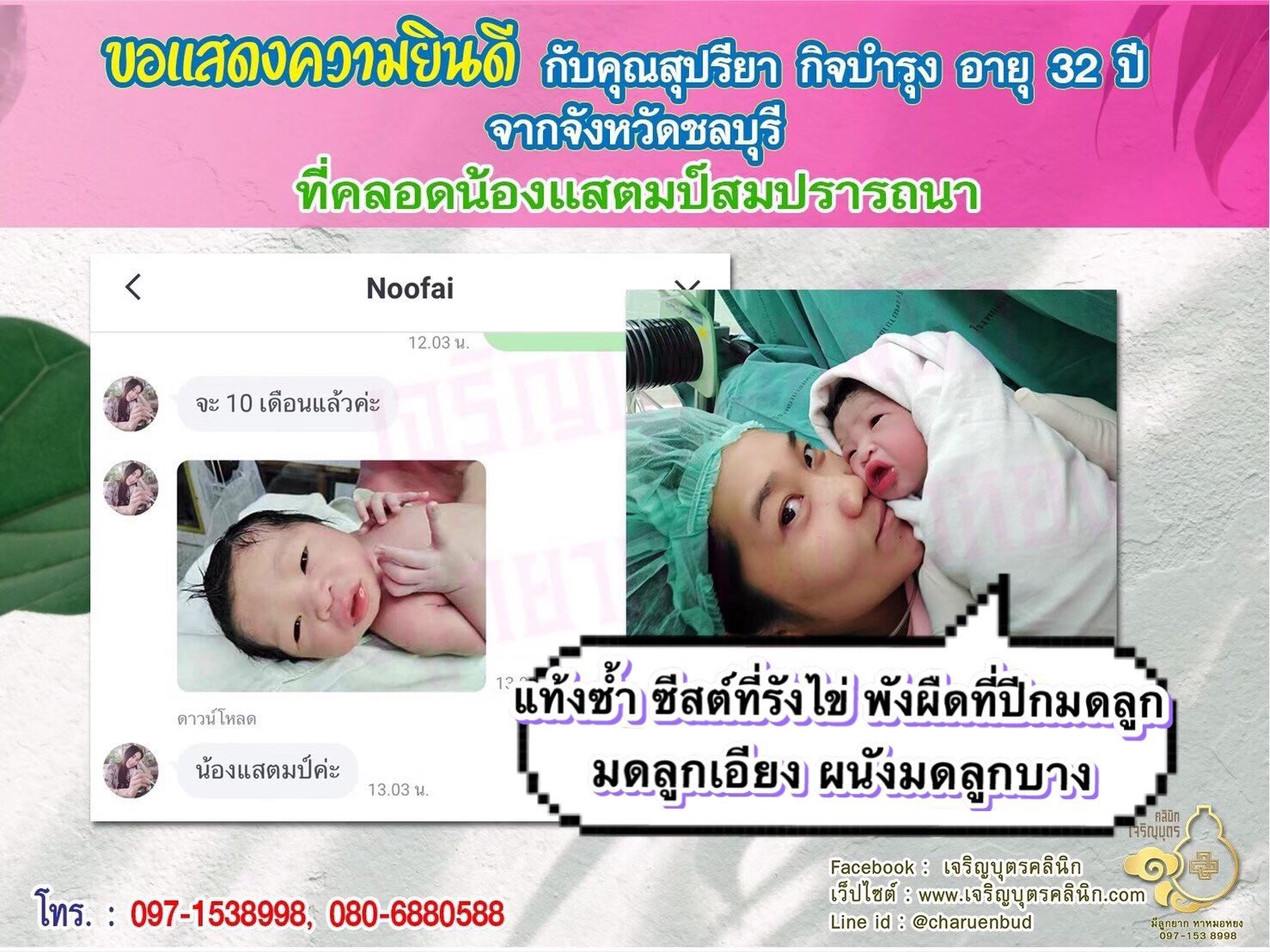 คุณสุปรียา กิจบำรุง อายุ 32 ปี จากชลบุรี ได้คลอดน้องแสตมป์เป็นที่เรียบร้อยแล้ว