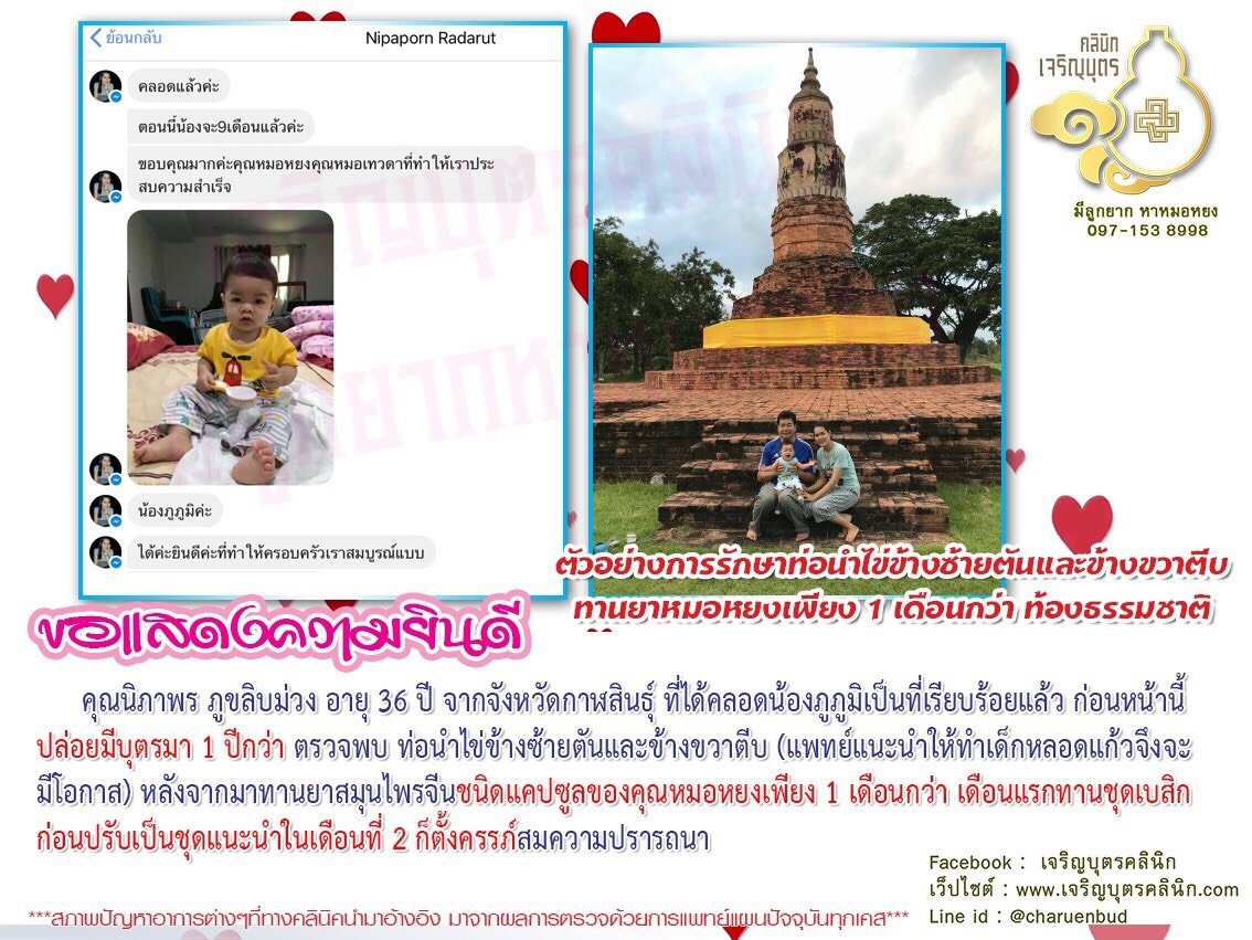 คุณนิภาพร ภูขลิบม่วง อายุ 36 ปี จากจังหวัดกาฬสินธุ์ ที่ได้คลอดน้องภูภูมิเป็นที่เรียบร้อยแล้ว