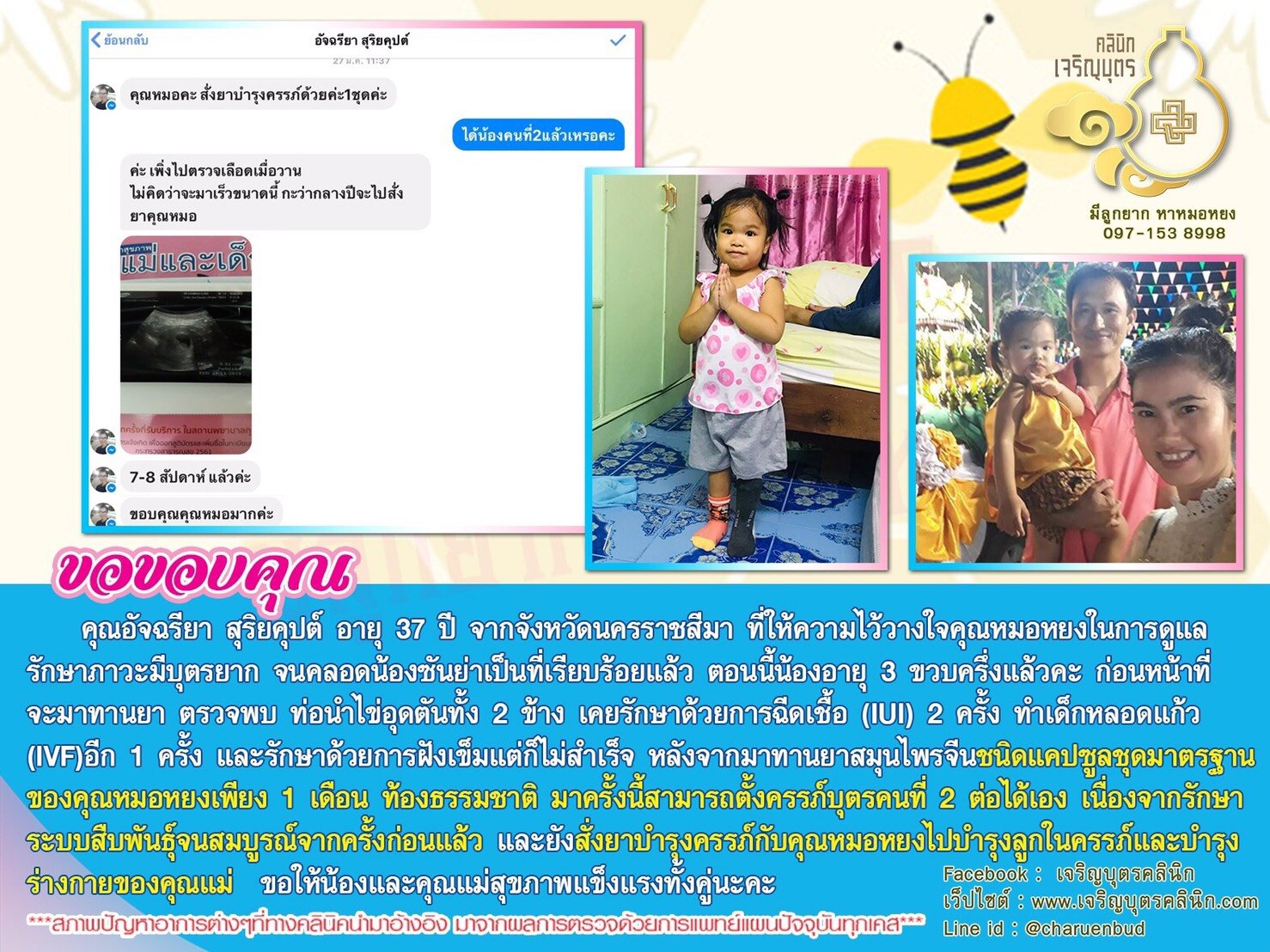 คุณอัจฉรียา สุริยคุปต์ อายุ 37 ปี จากจังหวัดนครราชสีมา ที่ให้ความไว้วางใจ คุณหมอหยงในการดูแลรักษาภาวะมีบุตรยาก จนคลอดน้องซันย่าเป็นที่เรียบร้อยแล้ว