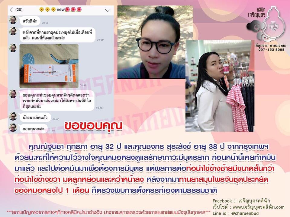 คุณณัฐนิชา ฤทธิภา อายุ 32 ปี และคุณชงกร สุระสังข์ อายุ 38 ปี จากกรุงเทพฯ ให้ความไว้วางใจคุณหมอหยงดูแลรักษาภาวะมีบุตรยาก