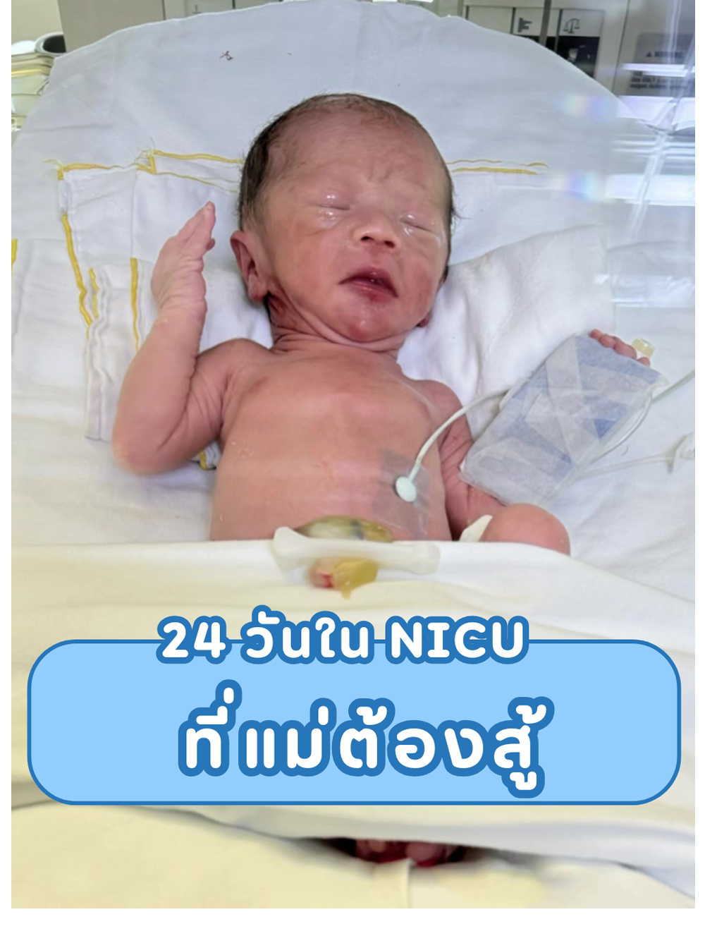 24 วัน NICU ที่แม่ต้องสู้ 24 วัน NICU ที่แม่ต้องสู้