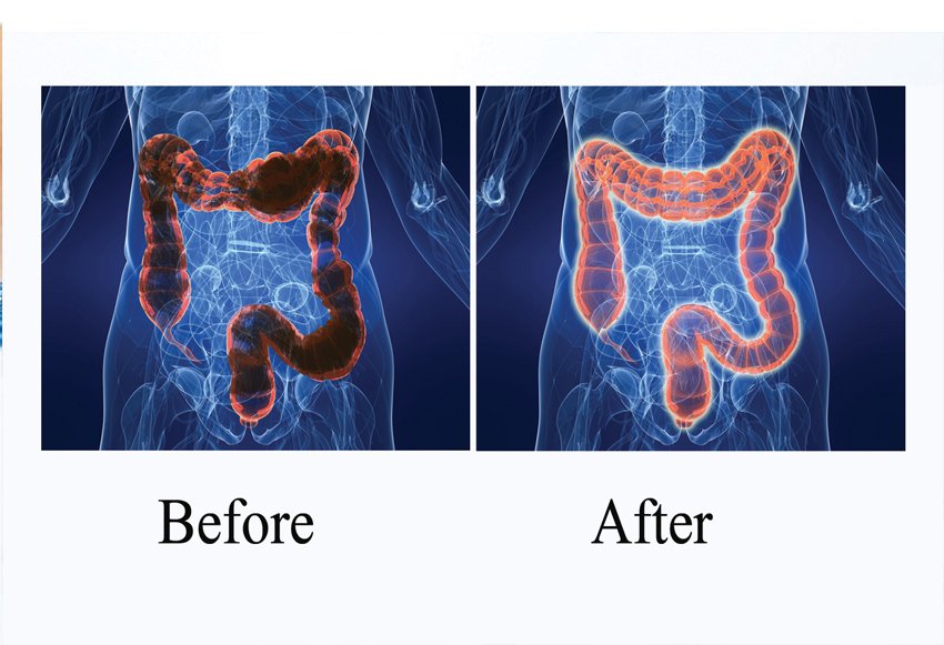 Colon Hydrotherapy