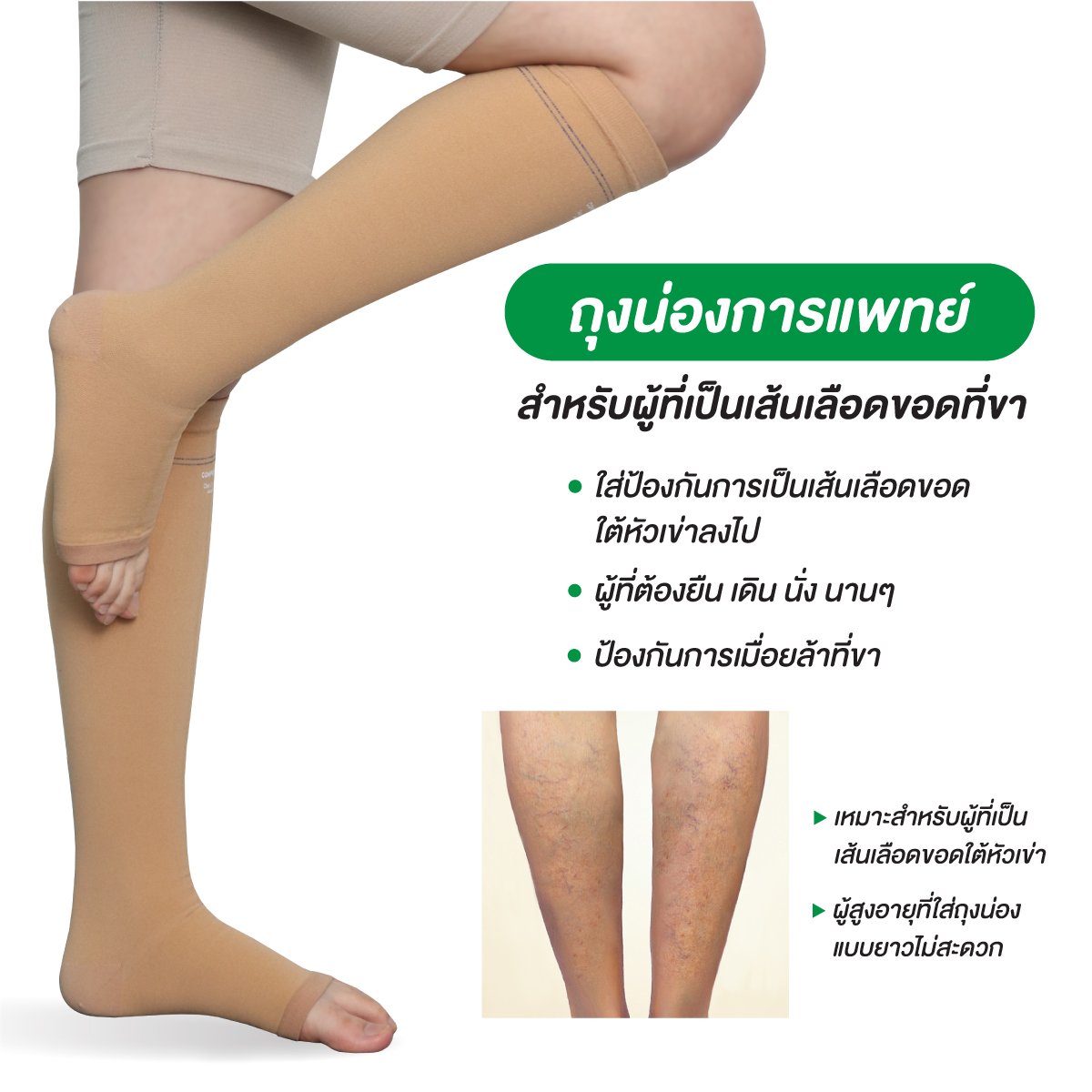 ถุงน่องป้องกันเส้นเลือดขอด (COMPREZON VARICOSE VEIN STOCKINGS AG