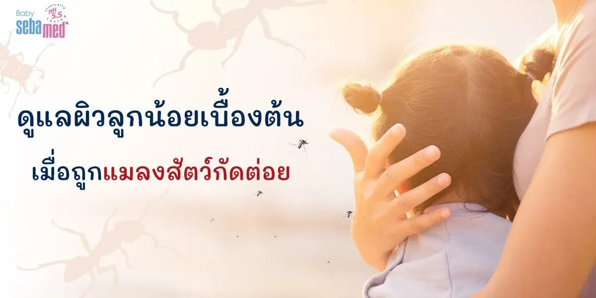 ดูแลผิวลูกน้อยเบื้องต้น เมื่อถูกแมลงสัตว์กัดต่อย