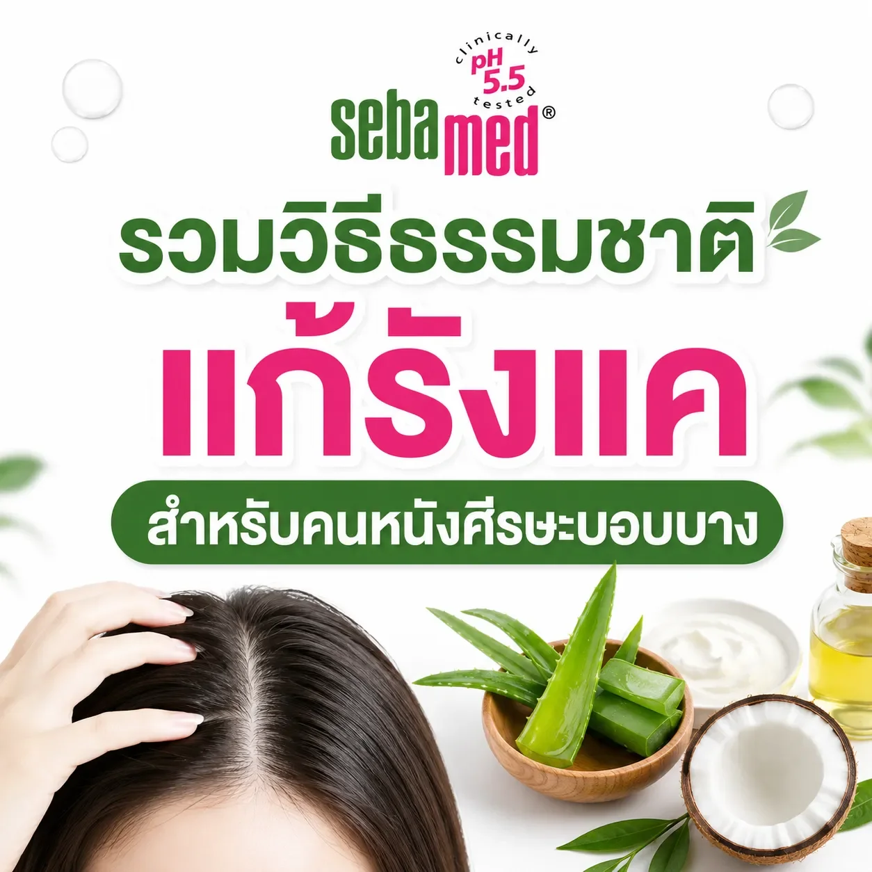 รวมวิธีธรรมชาติแก้รังแค_สำหรับคนหนังศีรษะบอบบาง_แพ้ง่าย