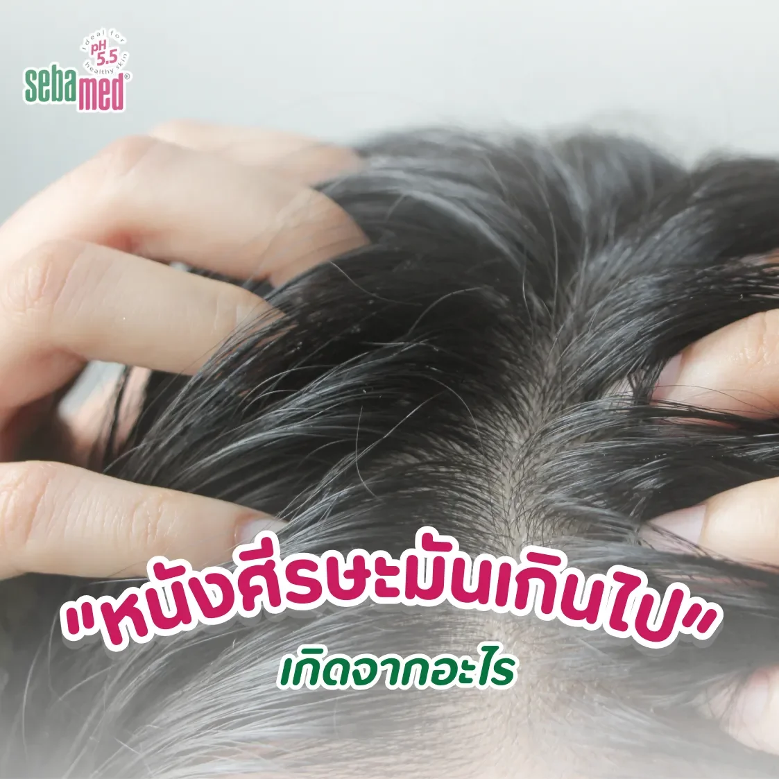 หนังศีรษะมันเกินไป_เกิดจากอะไร