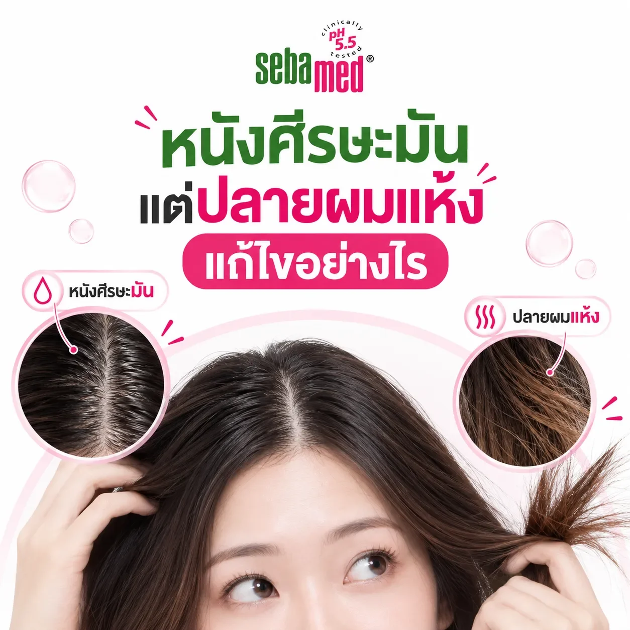 หนังศีรษะมันแต่ปลายผมแห้ง_แก้ไขอย่างไร