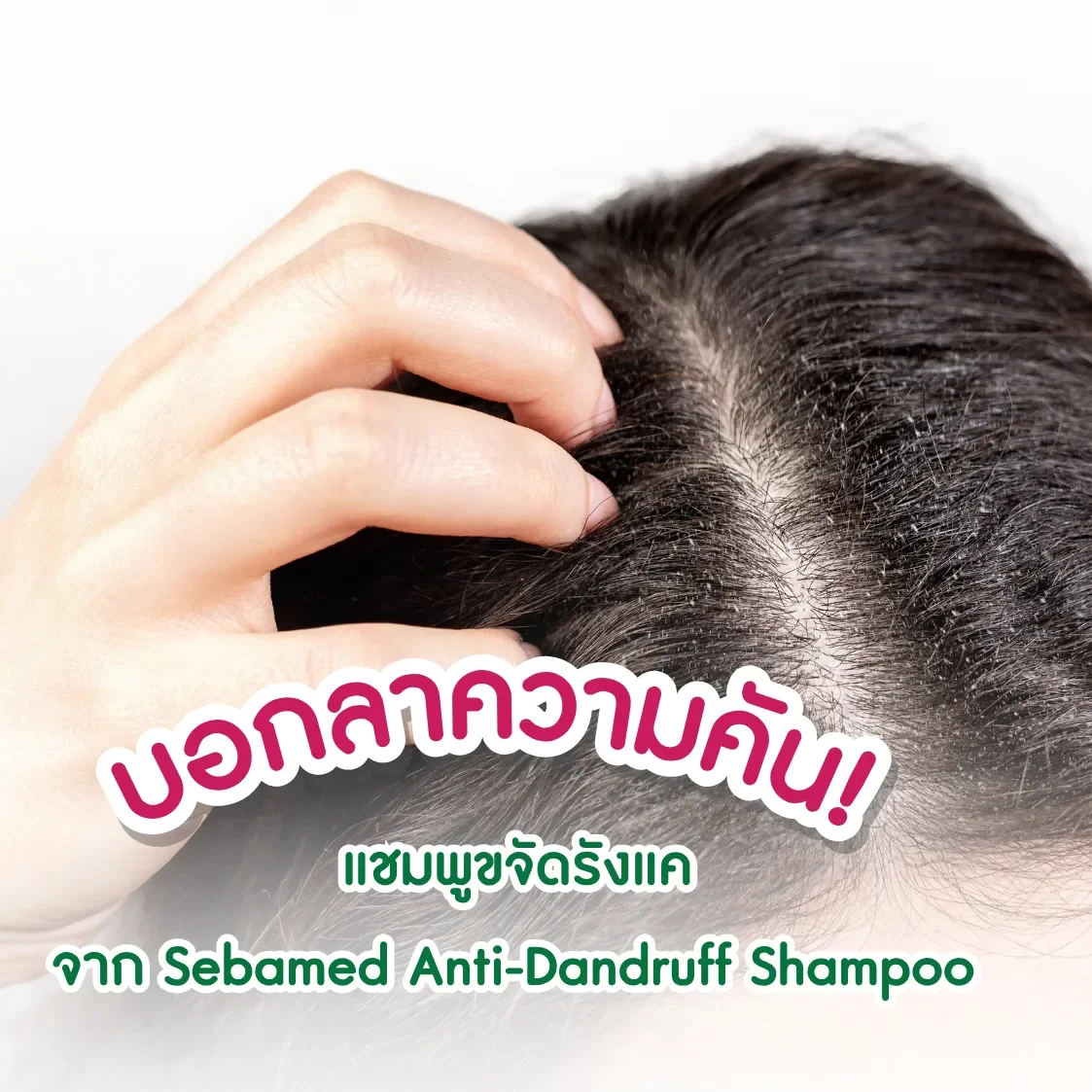 แชมพูขจัดรังแคจาก_Sebamed_Anti_Dandruff_Shampoo