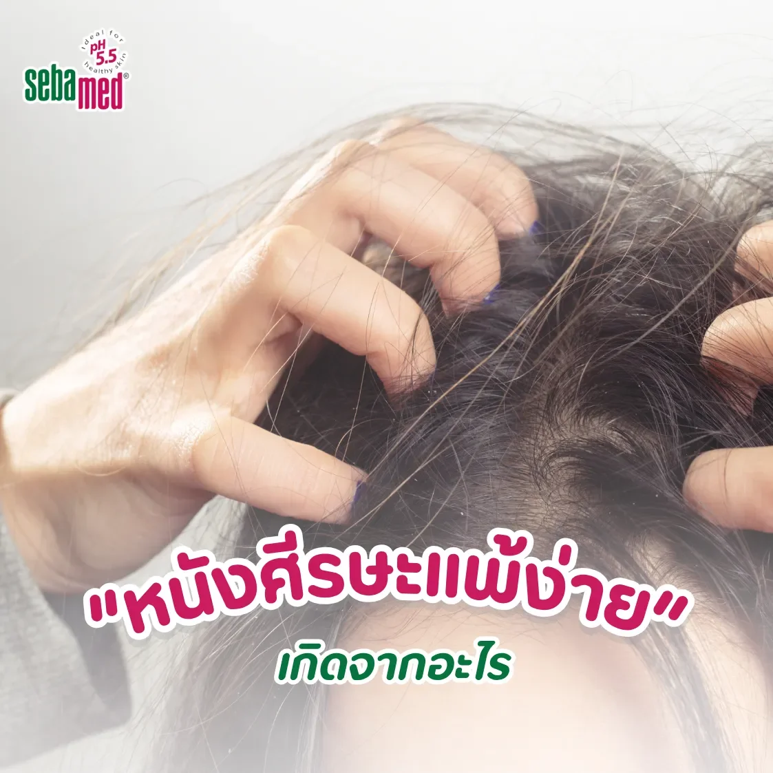 หนังศีรษพแพ้ง่ายเกดจากอะไร