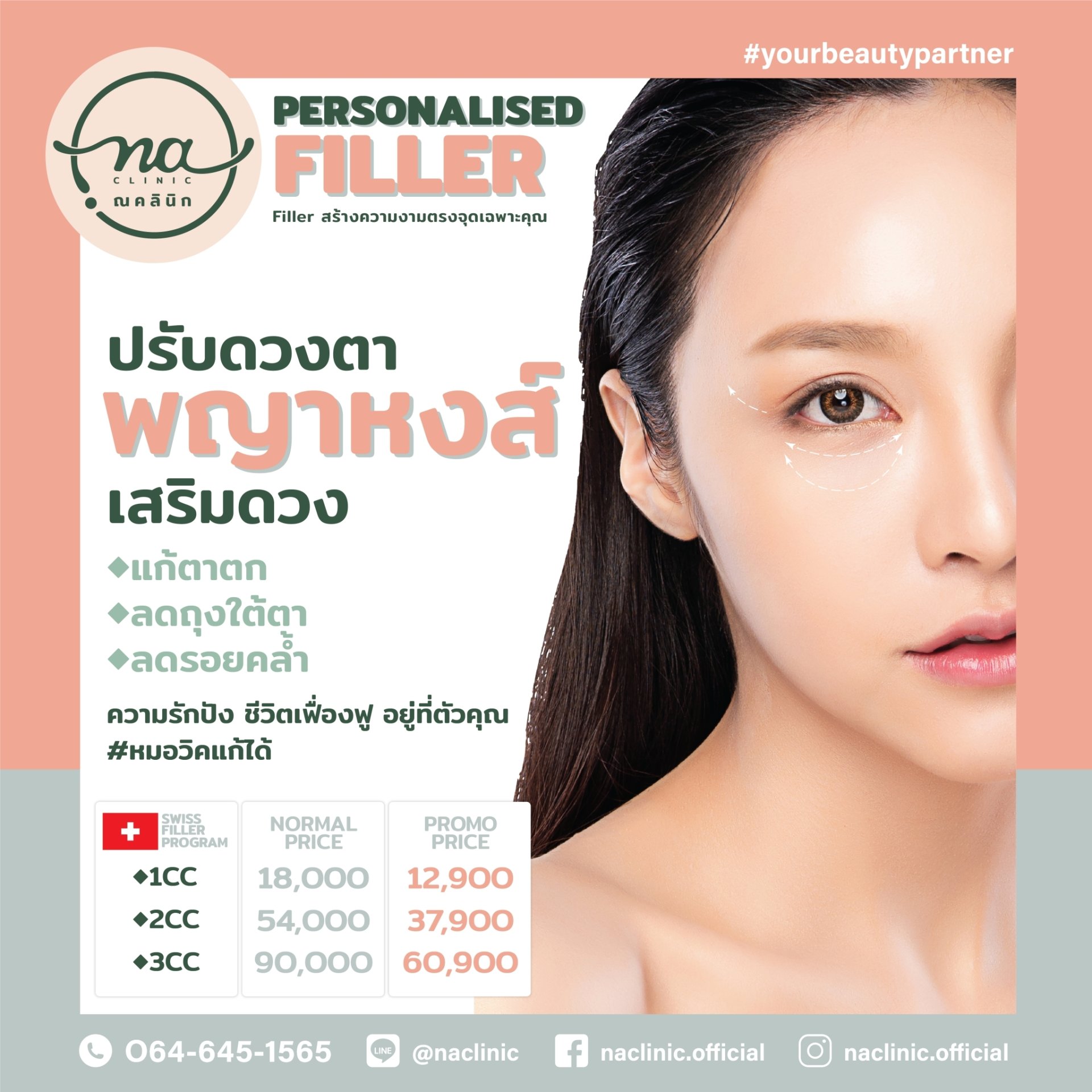 เติม Filler ดวงตาพญาหงส์