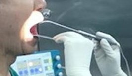 การใช้คลื่นความถี่วิทยุหลายระดับ รักษานอนกรน  การใช้คลื่นความถี่วิทยุหลายระดับ รักษานอนกรน