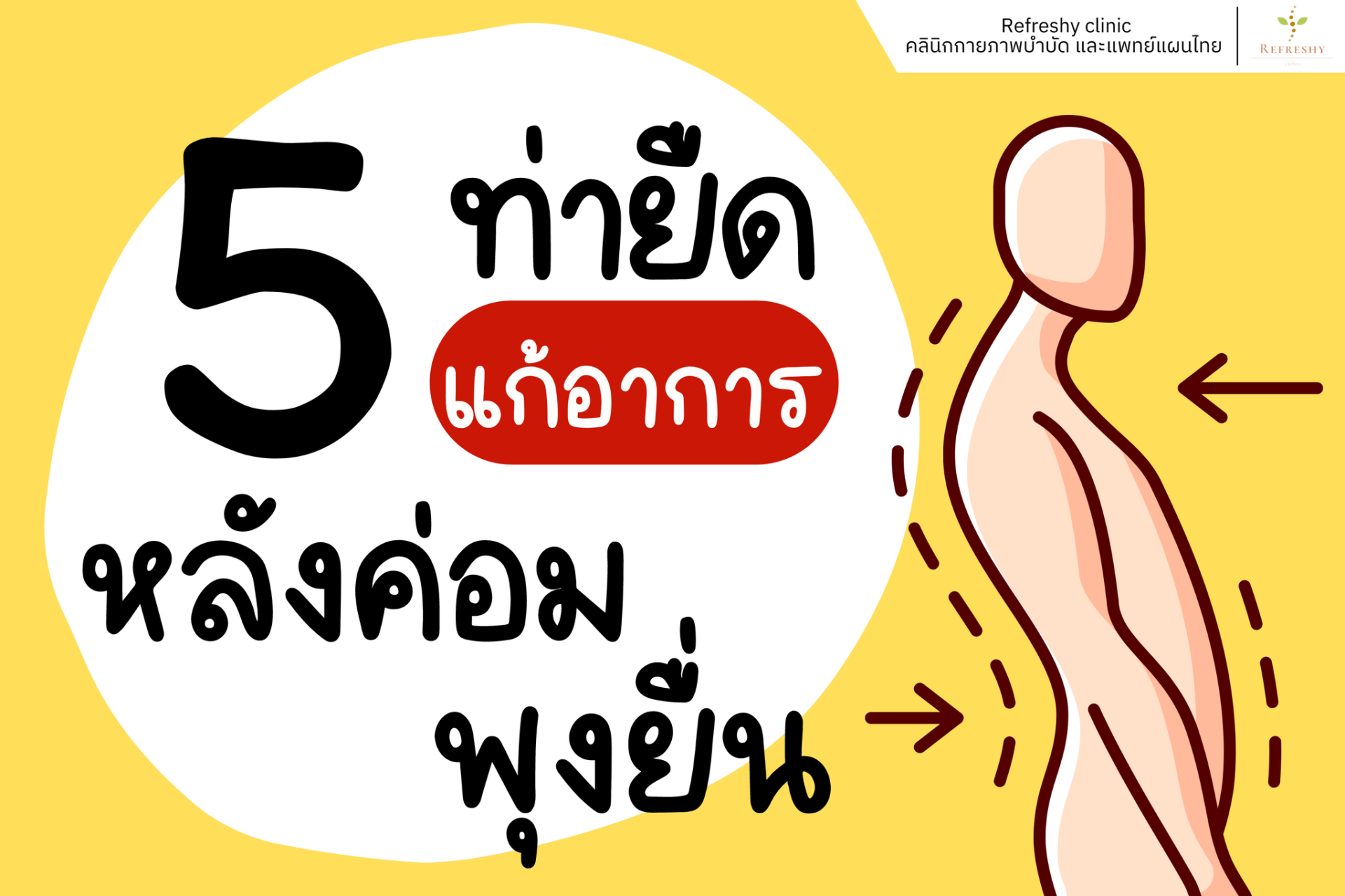 5 ท่ายืด แก้อาการหลังค่อม พุงยื่น