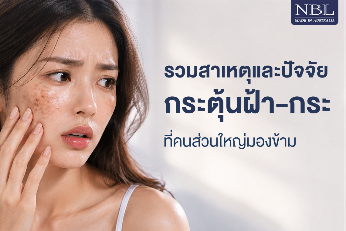 รวมสาเหตุเเละปัจจัยกระตุ้นฝ้า - กระ ที่คนส่วนใหญ่มองข้าม