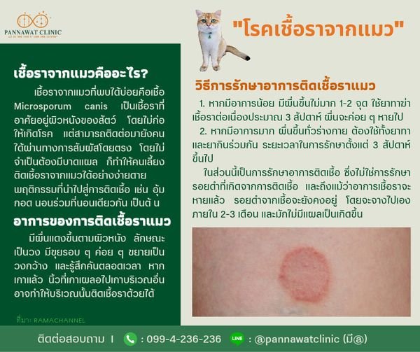 "โรคเชื้อราจากแมว" "โรคเชื้อราจากแมว"