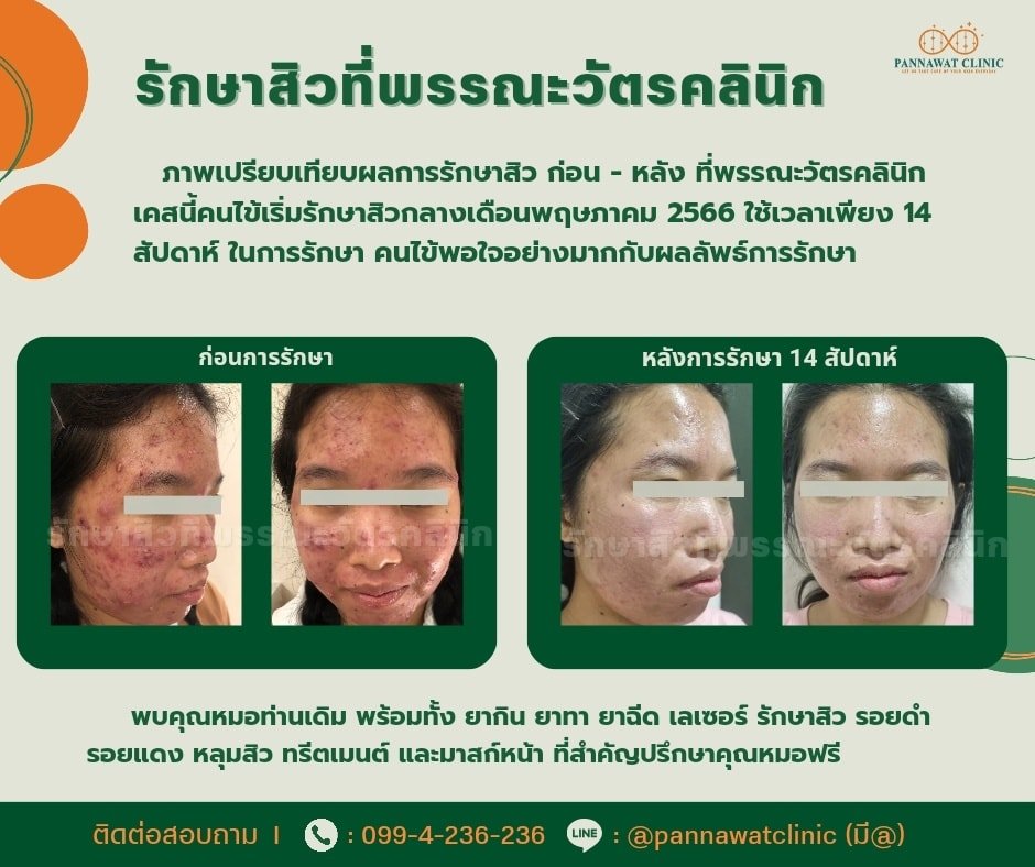 รีวิวคนไข้จริง รีวิวคนไข้จริง