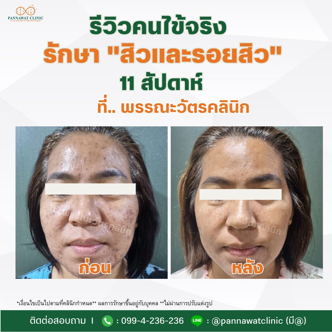 รีวิวคนไข้จริง รีวิวคนไข้จริง