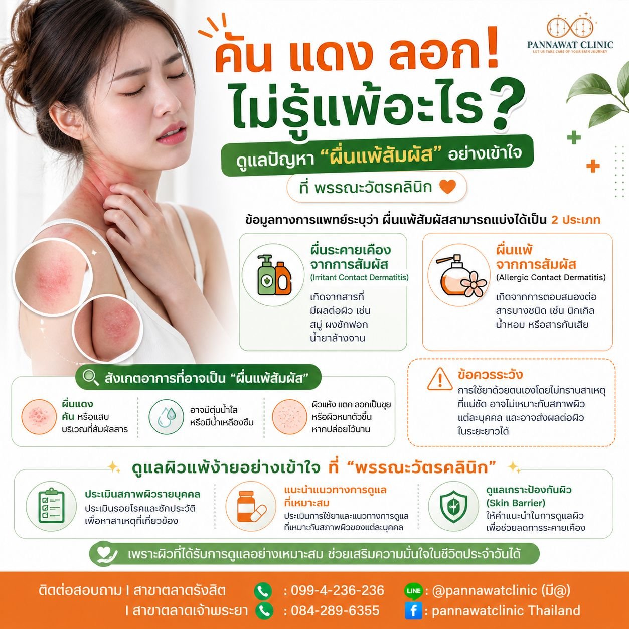   คันดูแลปัญหา ผื่นแพ้สัมผัส อย่างเข้าใจ ที่ พรรณะวัตรคลินิก  เนื้อหา: เคยไหมคะ? 