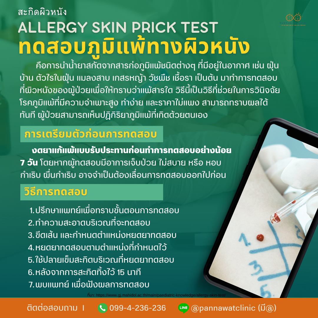 สะกิดผิวหนังทดสอบภูมิแพ้ทางผิวหนัง ALLERGY SKIN PRICK TEST สะกิดผิวหนังทดสอบภูมิแพ้ทางผิวหนัง ALLERGY SKIN PRICK TEST