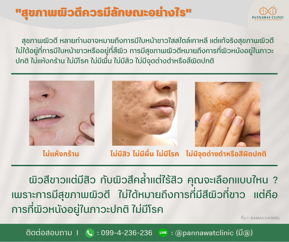"สุขภาพผิวดีควรมีลักษณะอย่างไร" "สุขภาพผิวดีควรมีลักษณะอย่างไร"