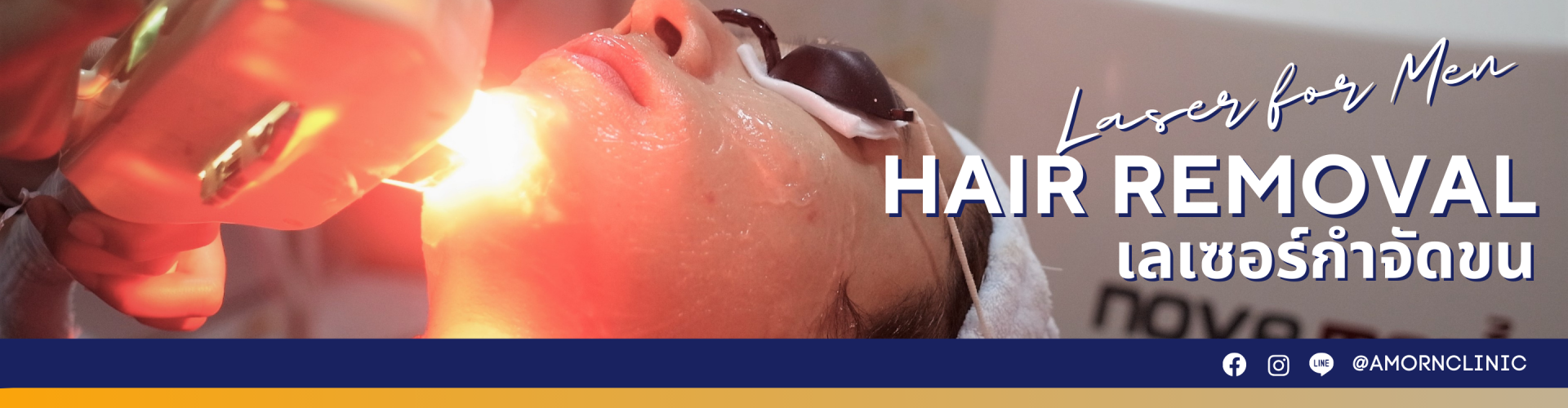 LASER HAIR REMOVAL | เลเซอร์กำจัดขน