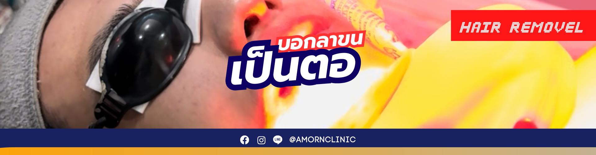 LASER HAIR REMOVAL | เลเซอร์กำจัดขน
