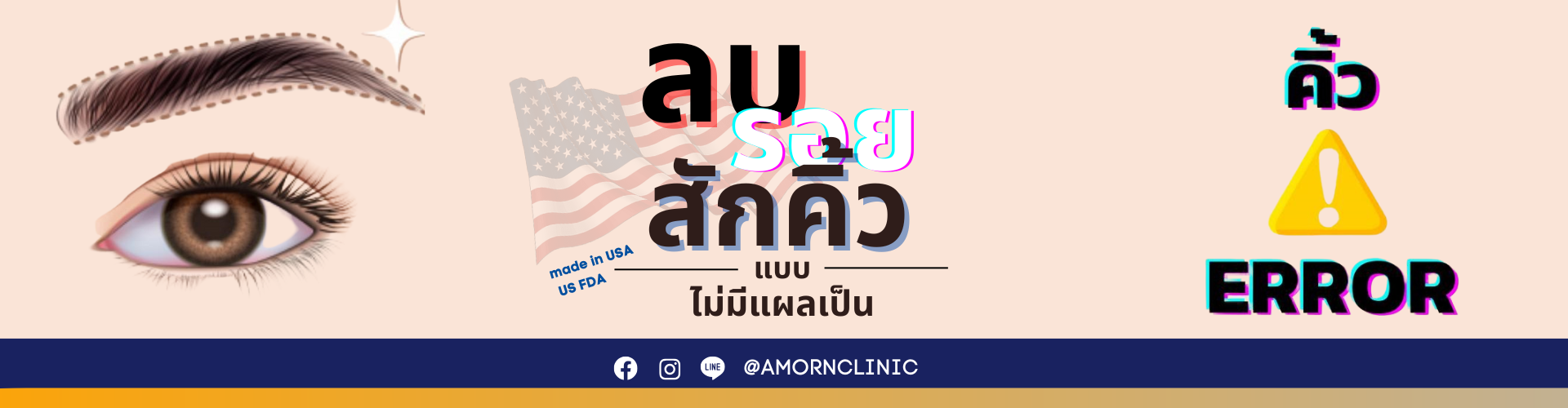 ลบรอยสัก