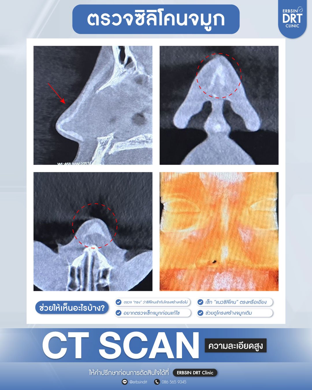 CT Scan จมูก