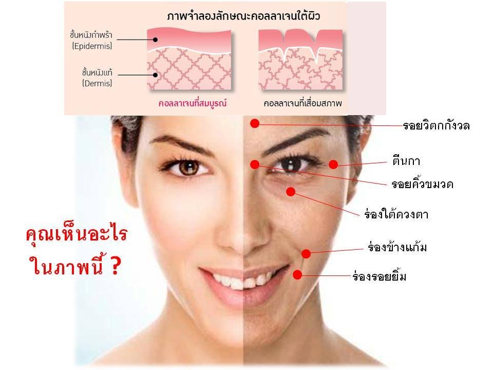 เช็ค 3 อาการ ร่างกายขาด คอลาเจนไหม? เช็ค 3 อาการ ร่างกายขาด คอลาเจนไหม?