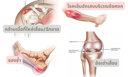 ฉีดกลูโคส