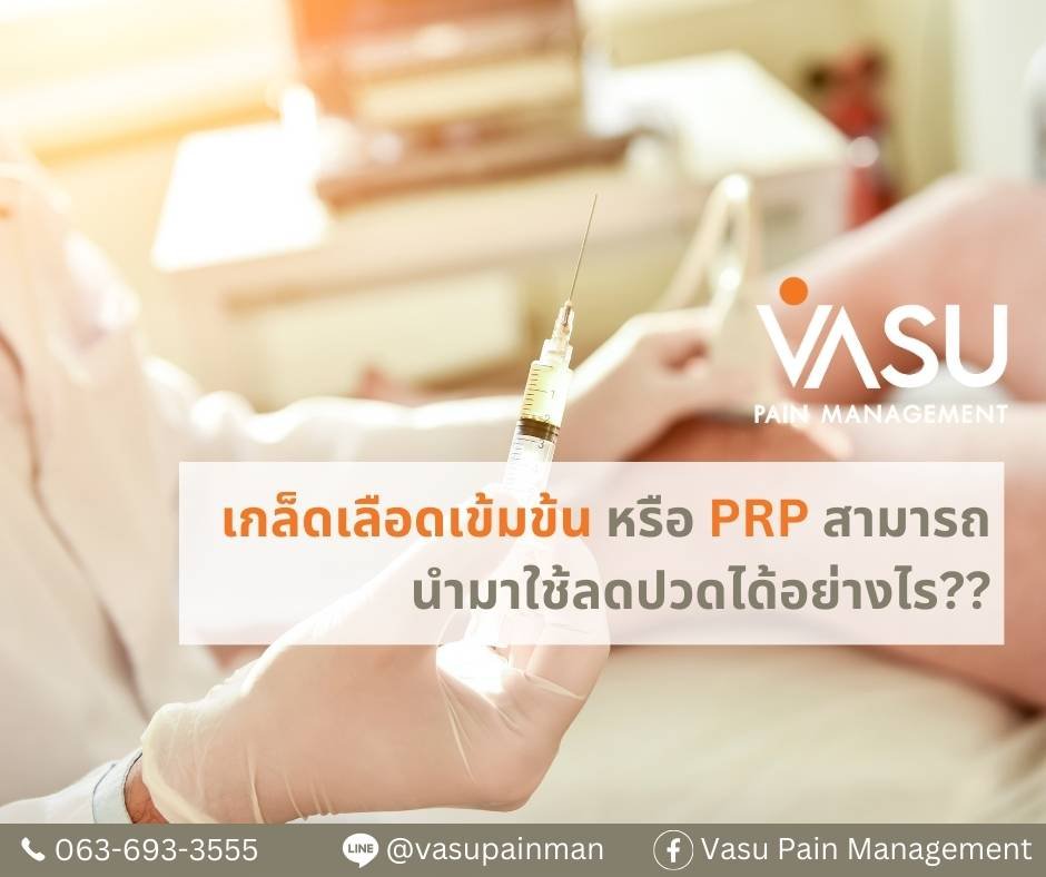 PRP ฉีดเกล็ดเลือดปั่น