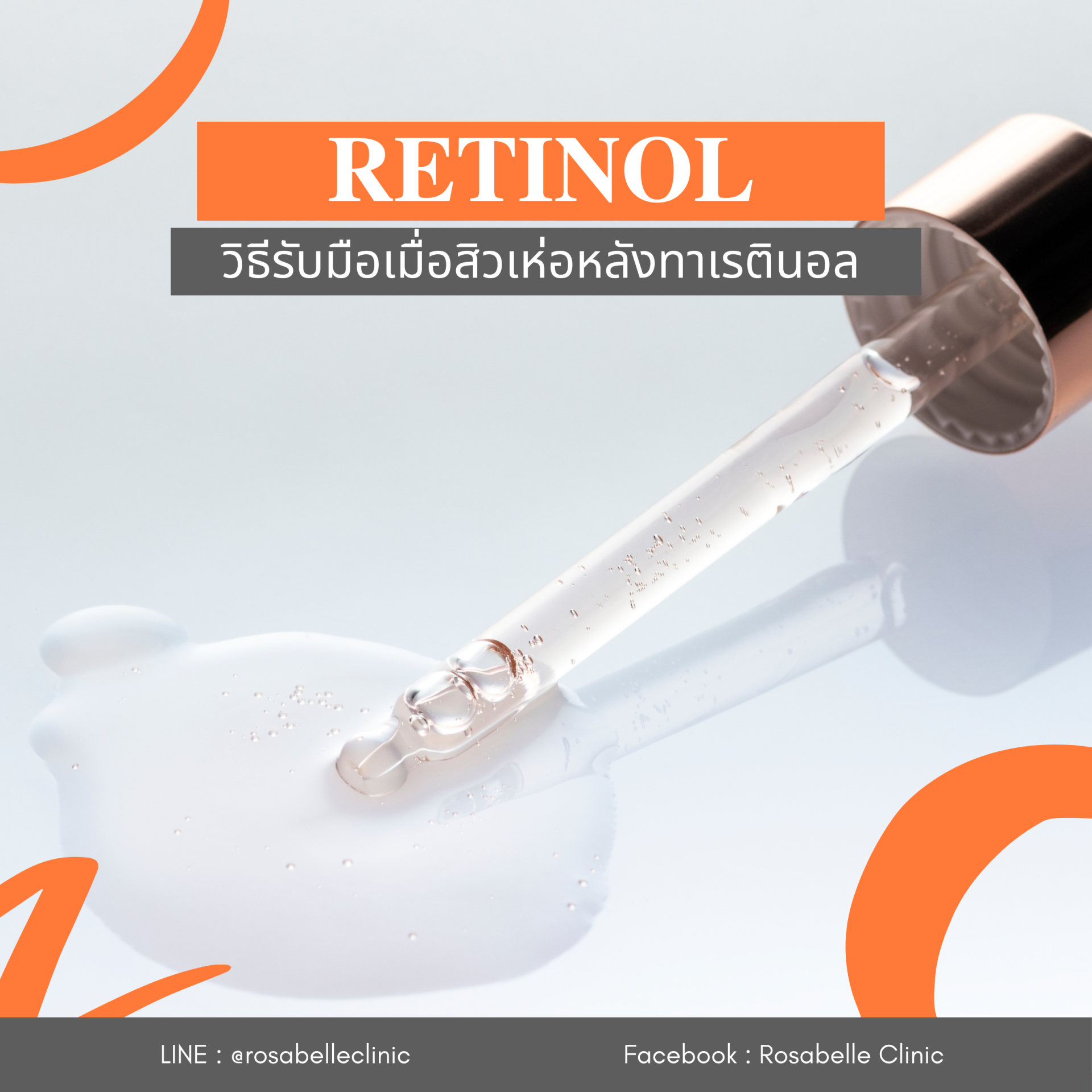 วิธีรับมือเมื่อสิวเห่อหนักจากการทาเรตินอล Retinol