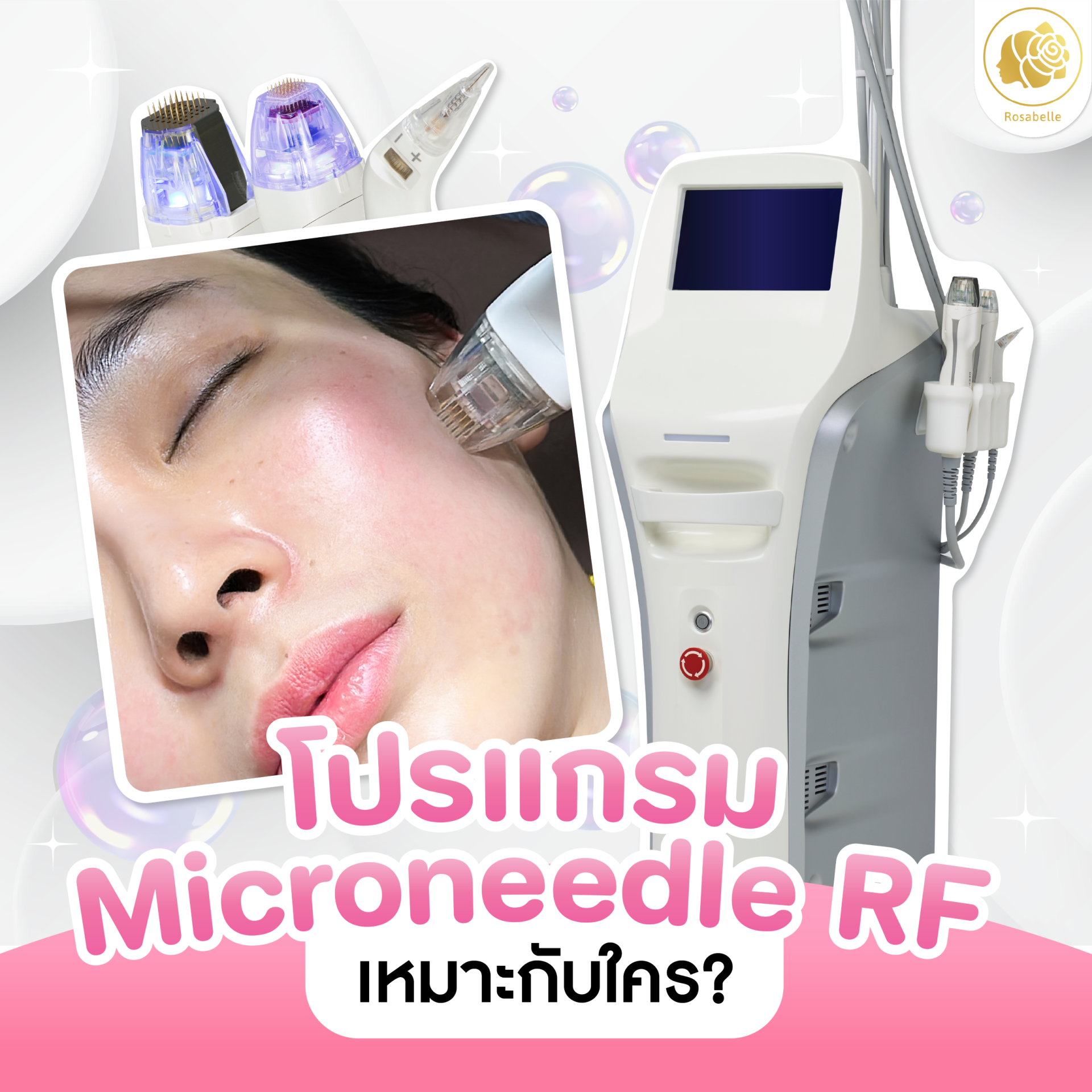Microneedle RF คืออะไร? เหมาะกับใคร และมีการพักฟื้นอย่างไร?
