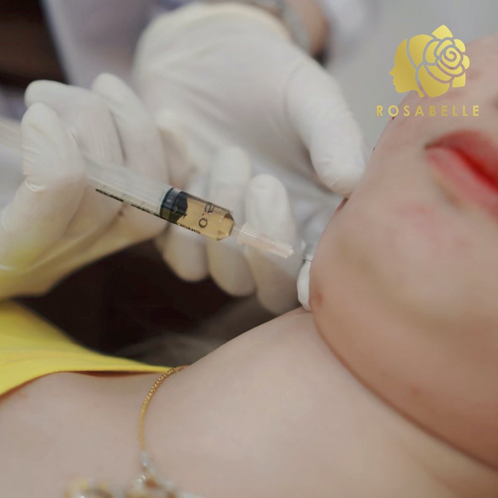 เมโสแฟต สลายไขมัน คืออะไร? ข้อปฏิบัติหลังการฉีดแฟต เมโสแฟต สลายไขมัน คืออะไร? ข้อปฏิบัติหลังการฉีดแฟต